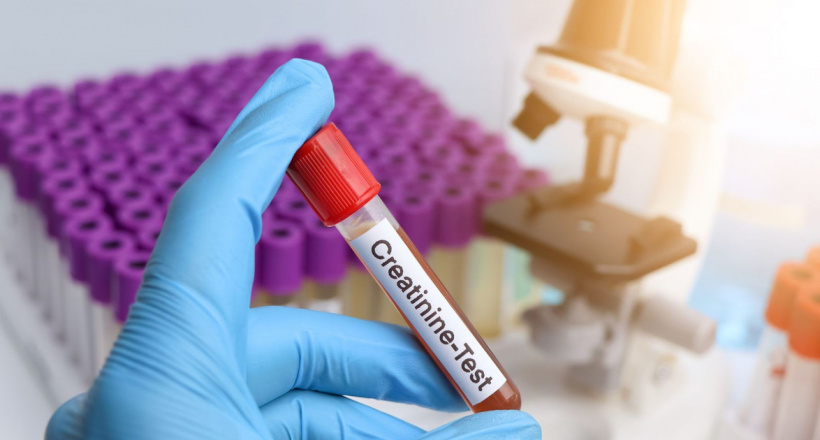 Các giai đoạn suy thận theo creatinin và phương pháp điều trị